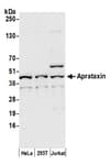 Detection of human Aprataxin by western blot.