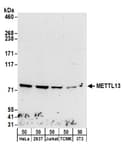 Detection of human and mouse METTL13 by western blot.