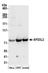 Detection of human AFG3L2 by western blot.