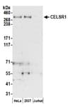 Detection of human CELSR1 by western blot.