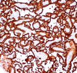 Detection of human PLAP by immunohistochemistry.