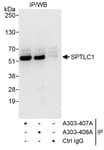 Detection of human SPTLC1 by western blot of immunoprecipitates.