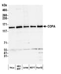 Detection of human COPA by western blot.