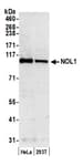 Detection of human NOL1 by western blot.