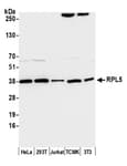 Detection of human and mouse RPL5 by western blot.
