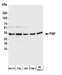 Detection of mouse PGP by western blot.