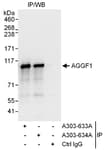 Detection of human AGGF1 by western blot of immunoprecipitates.