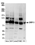 Detection of human and mouse ORP11 by western blot.