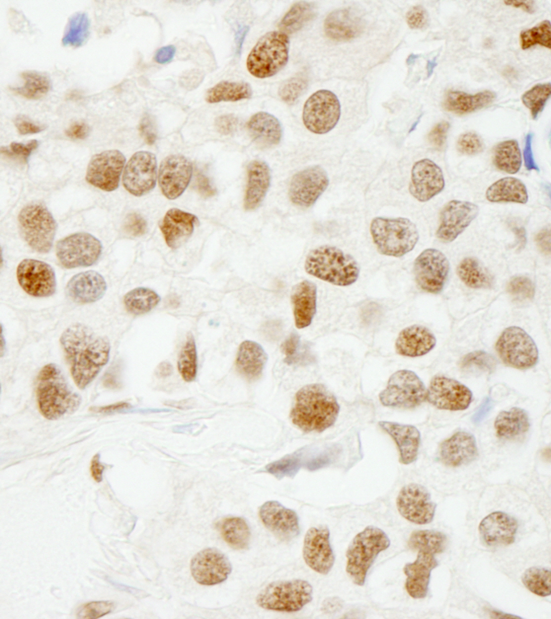 Rabbit anti-SAM68 IHC Antibody