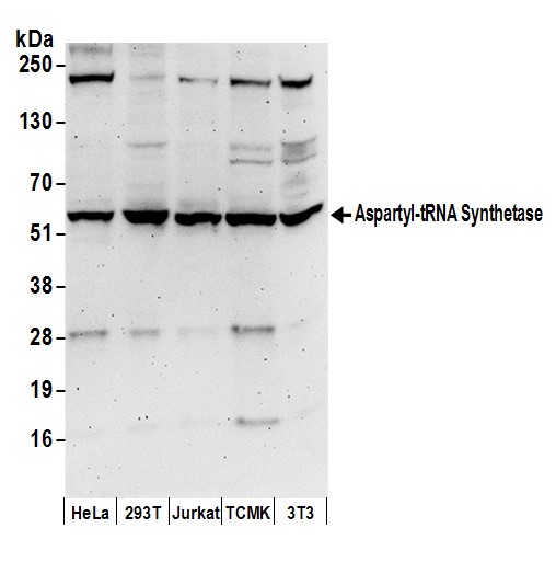 Detection of human and mouse Aspartyl-tRNA Synthetase by western blot.