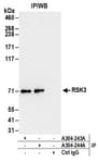 Detection of human RSK3 by western blot of immunoprecipitates.