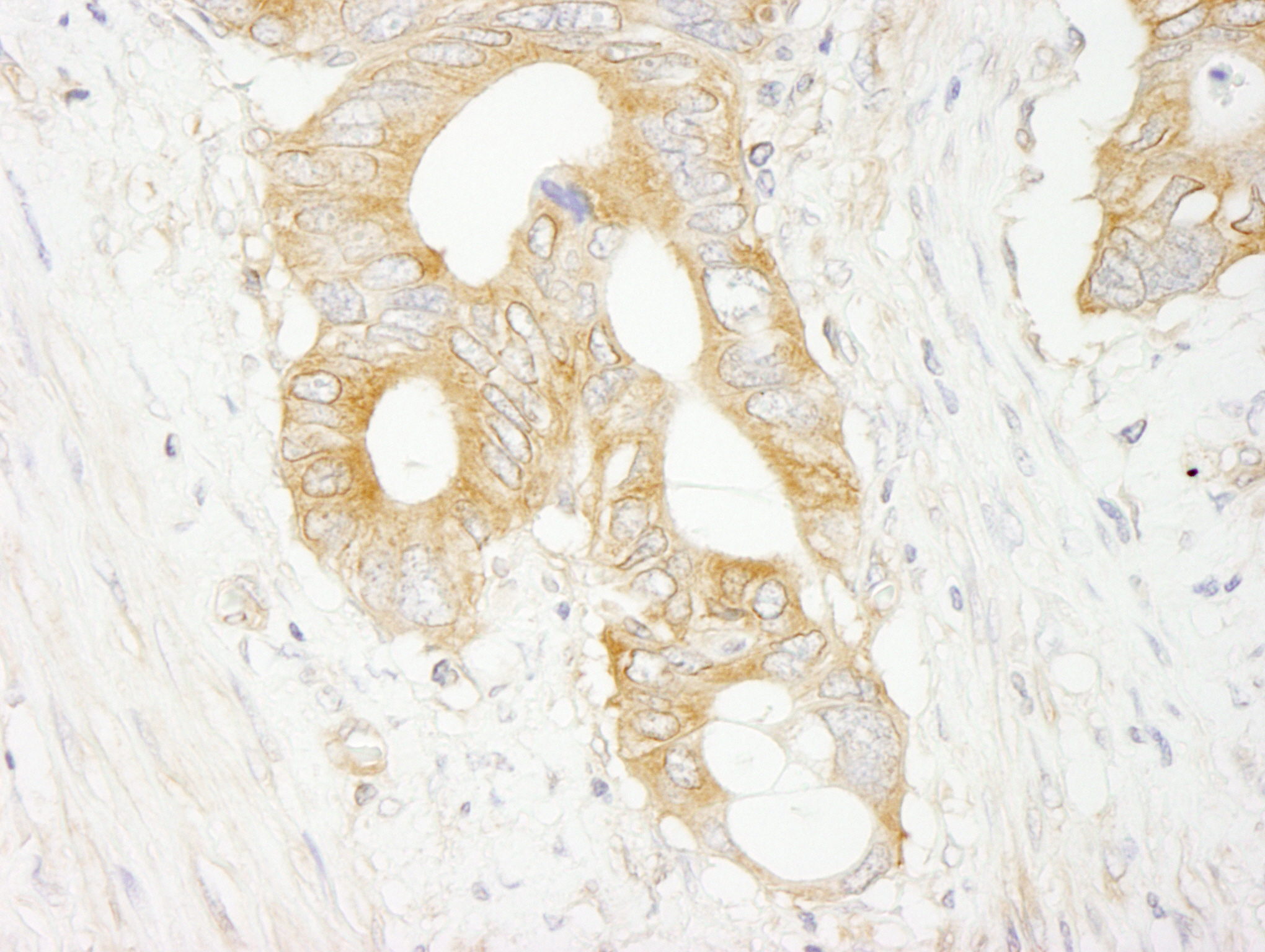 Rabbit anti-eIF3J/EIF3S1 IHC Antibody