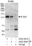 Detection of human E-Syt1 by western blot of immunoprecipitates.