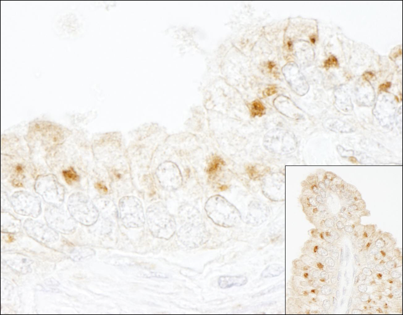Rabbit anti-GBF1 IHC Antibody