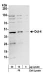 Detection of mouse Oct-4 by western blot.
