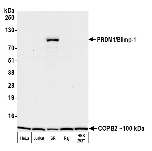 Rabbit Anti Prdm1blimp 1 Recombinant Monoclonal Antibody Blr247l Fortis Life Sciences 2122