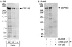 Detection of human CEP192 by western blot and immunoprecipitation.
