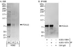 Detection of human FOXJ3 by western blot and immunoprecipitation.