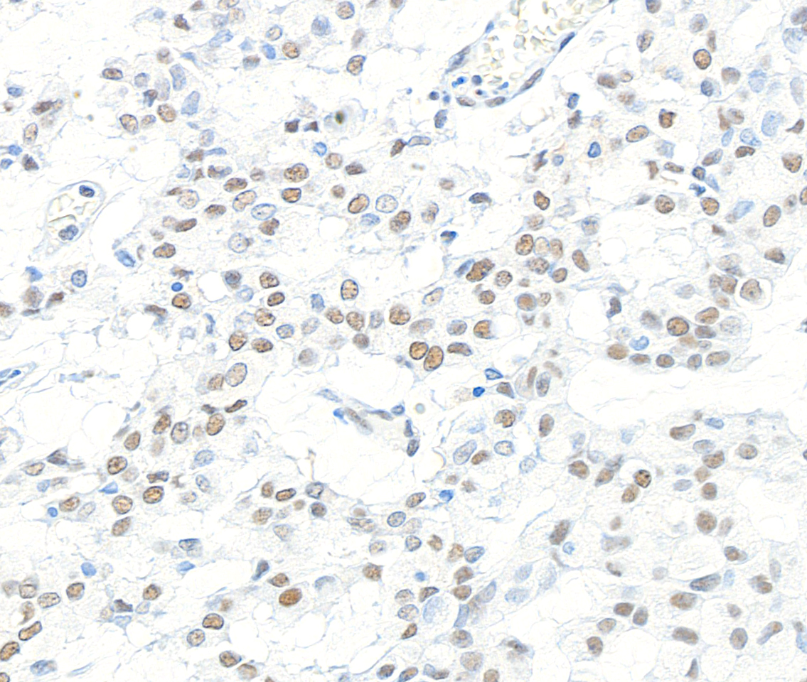Detection of human CPSF160 by immunohistochemistry.