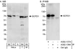 Detection of human and mouse SCFD1 by western blot (h&amp;m) and immunoprecipitation (h).