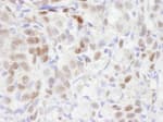 Detection of human TBLR1 by immunohistochemistry.