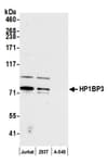 Detection of human HP1BP3 by western blot.