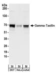 Detection of human Gamma-Taxilin by western blot.