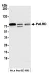 Detection of human PALMD by western blot.