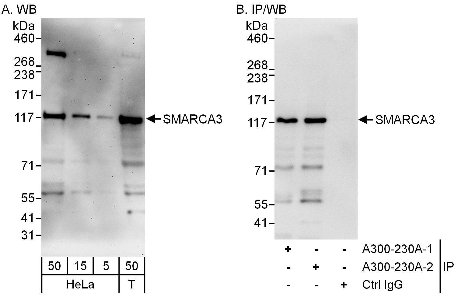 Detection of human SMARCA3 by western blot and immunoprecipitation.