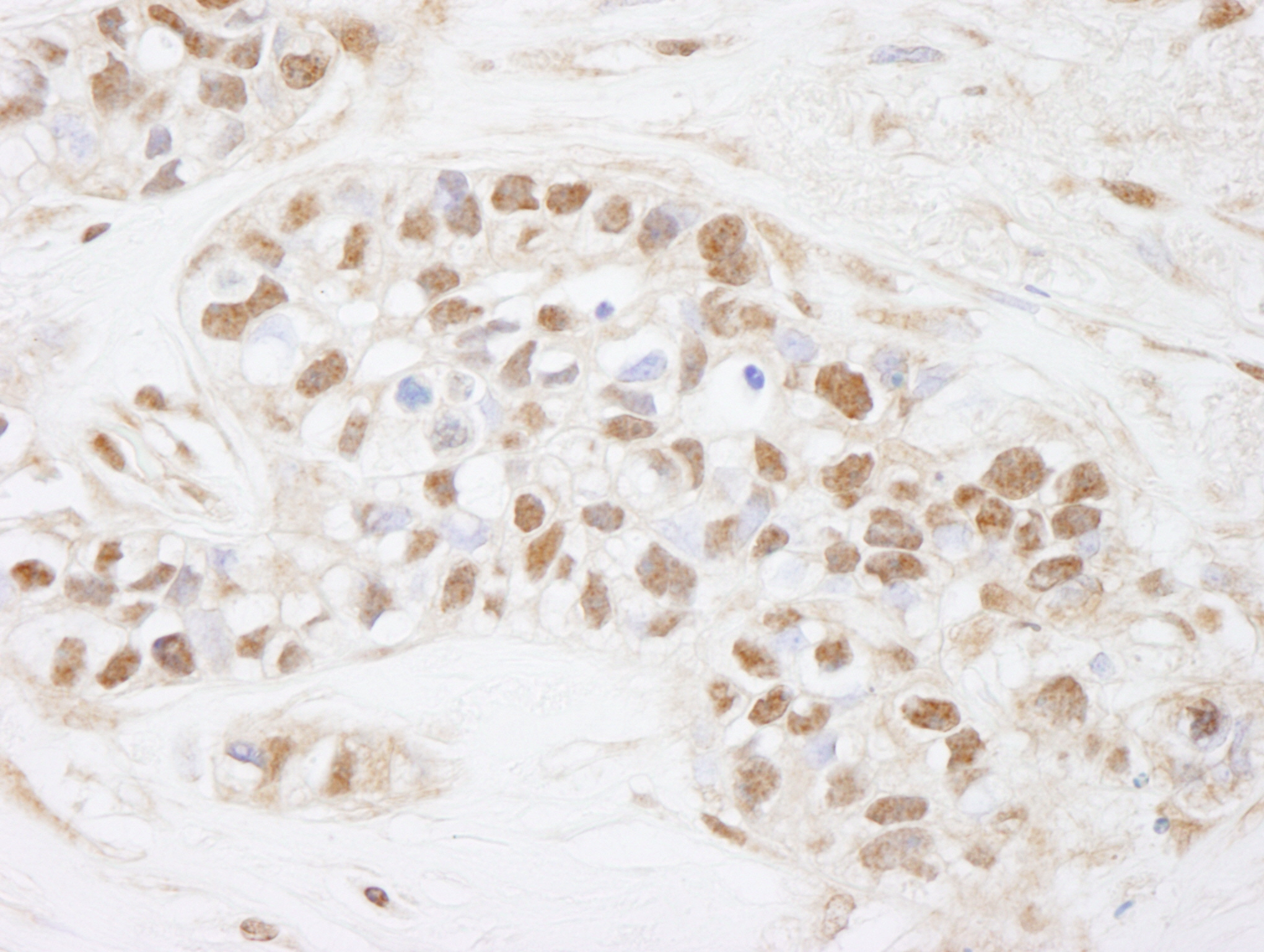 Rabbit anti-CDC25c IHC Antibody