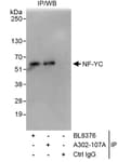 Detection of human NF-YC by western blot of immunoprecipitates.