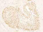 Detection of human SA1 by immunohistochemistry.