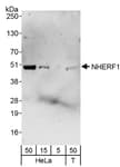 Detection of human NHERF1 by western blot.