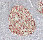 Detection of human Bcl6 by immunohistochemistry.