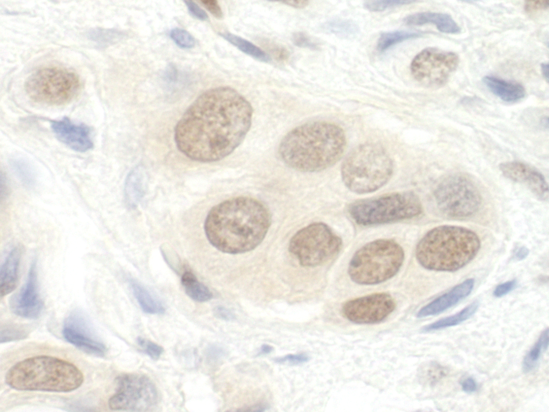 Rabbit anti-DGCR8 IHC Antibody