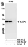 Detection of human SUCLA2 by western blot of immunoprecipitates.