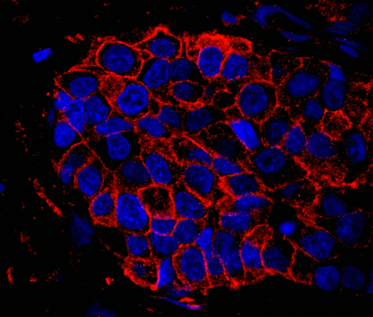 Rabbit anti-IQGAP1 IHC Antibody
