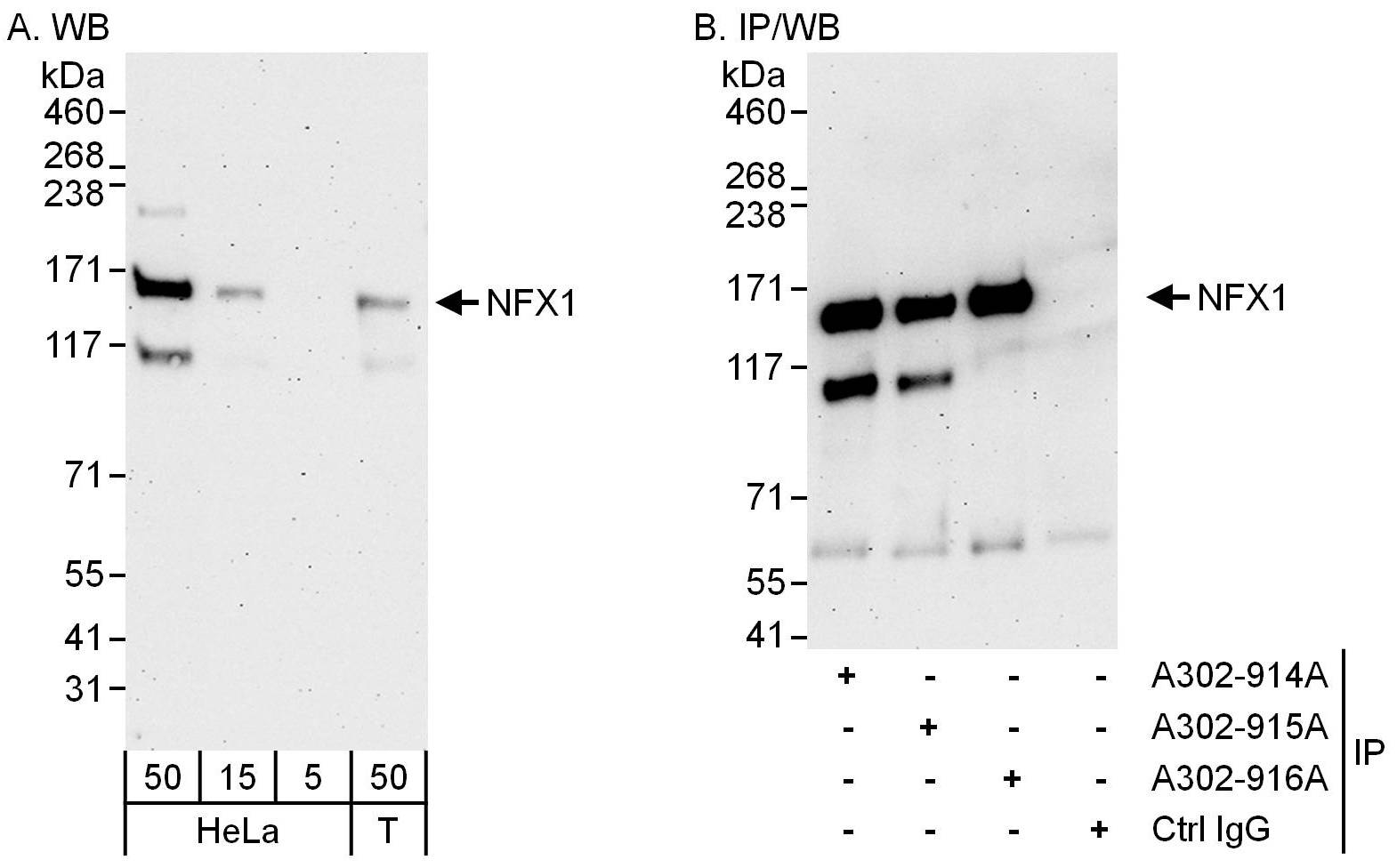 Detection of human NFX1 by western blot and immunoprecipitation.
