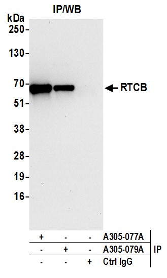 Detection of human RTCB by western blot of immunoprecipitates.