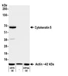 Detection of human Cytokeratin 5 by western blot.