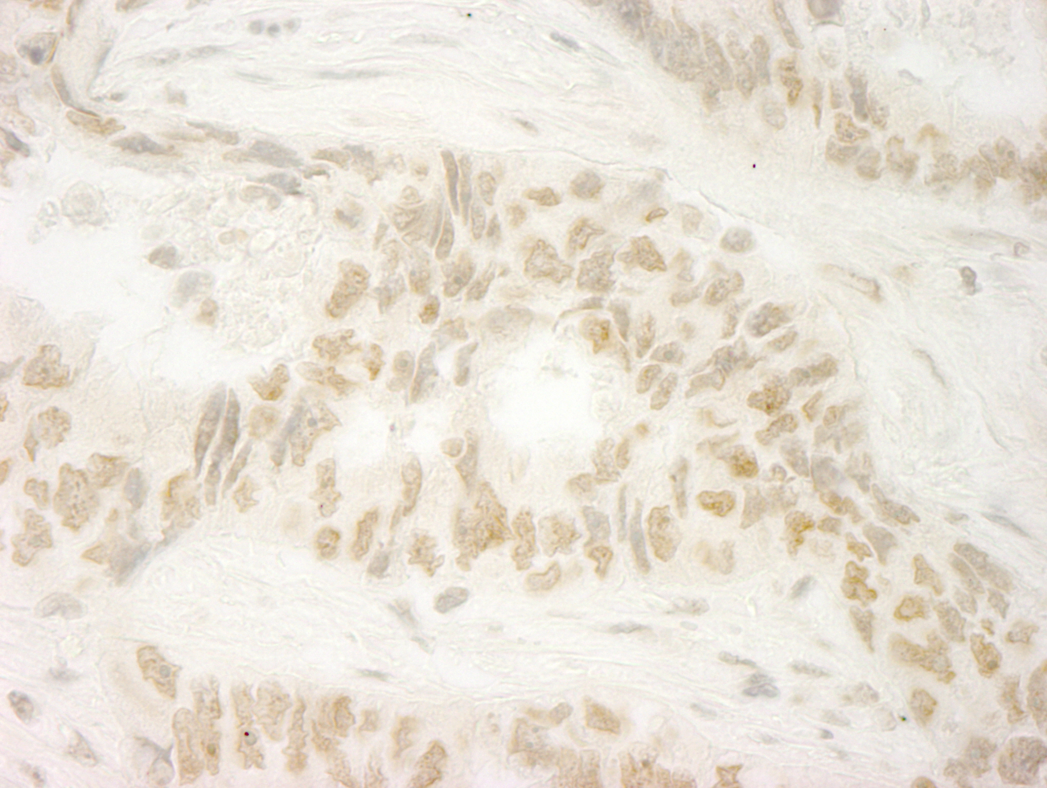 Rabbit anti-MKRN1 IHC Antibody