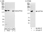 Detection of human SUPT5H by western blot and immunoprecipitation.