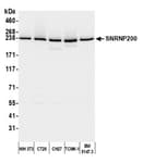 Detection of mouse SNRNP200 by western blot.