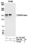 Detection of human PDGFR alpha by western blot of immunoprecipitates.