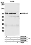 Detection of human CAP-H2 by western blot of immunoprecipitates.