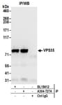 Detection of human VPS35 by western blot of immunoprecipitates.