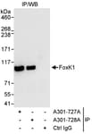 Detection of human FOXK1 by western blot of immunoprecipitates.