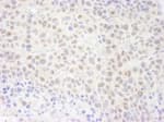 Detection of mouse RPA70 by immunohistochemistry.