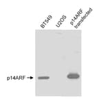 Detection of human p14ARF by western blot.