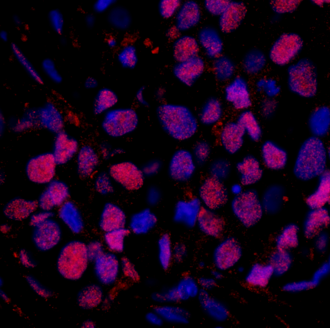 Rabbit anti-RAD23B IHC Antibody
